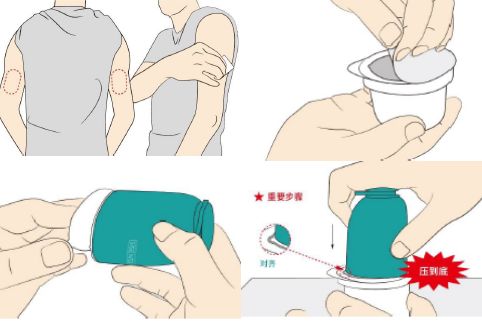 攜帶血糖儀游泳 敷貼器的實際體驗與注意事項